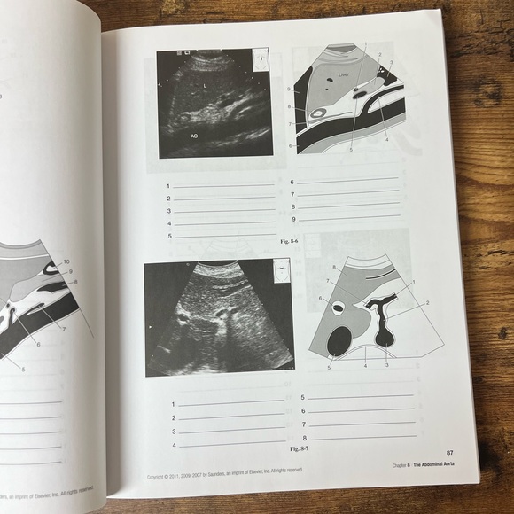 Sonography Introduction to Normal Structure and function Workbook and Lab manual - Picture 3 of 7